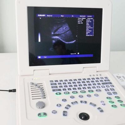 品質 GYN Factory Supply Dw580 Portable Ultrasound Machine For Sale 工場
