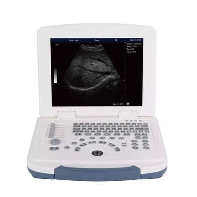 Hot Selling Plastic Medical Ultrasound Machine Ultrasound Scanner