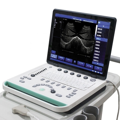 PRUS-S8000 15inch Laptop Ultrasound Scanner Machine PRUS-S8000