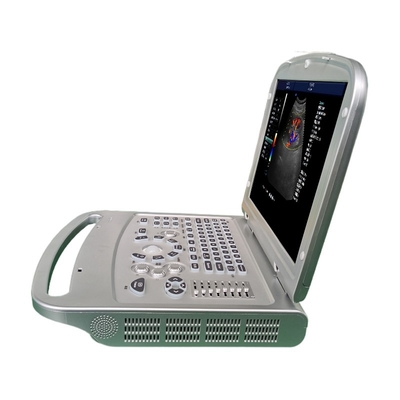 Black And White Metal OEM Laptop Ultrasound Medical Instruments Ultrasound Scanner Ultrasound Machine For Sale